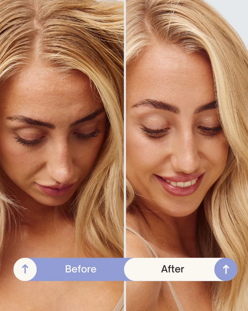 Refresh Powderâ„¢ Dry Shampoo - Image 4