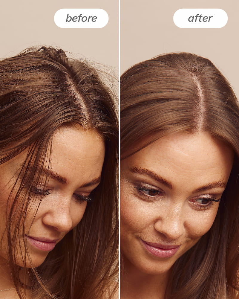 Scalp Delight™ Detox Scrub - Image 5